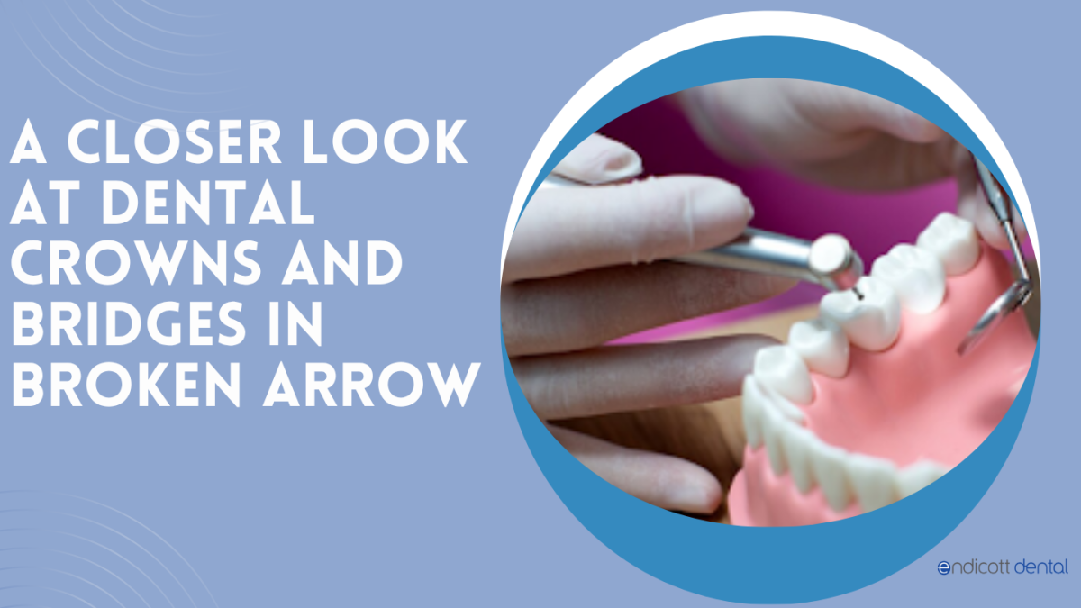 Featured image for Auto-prepared featured image