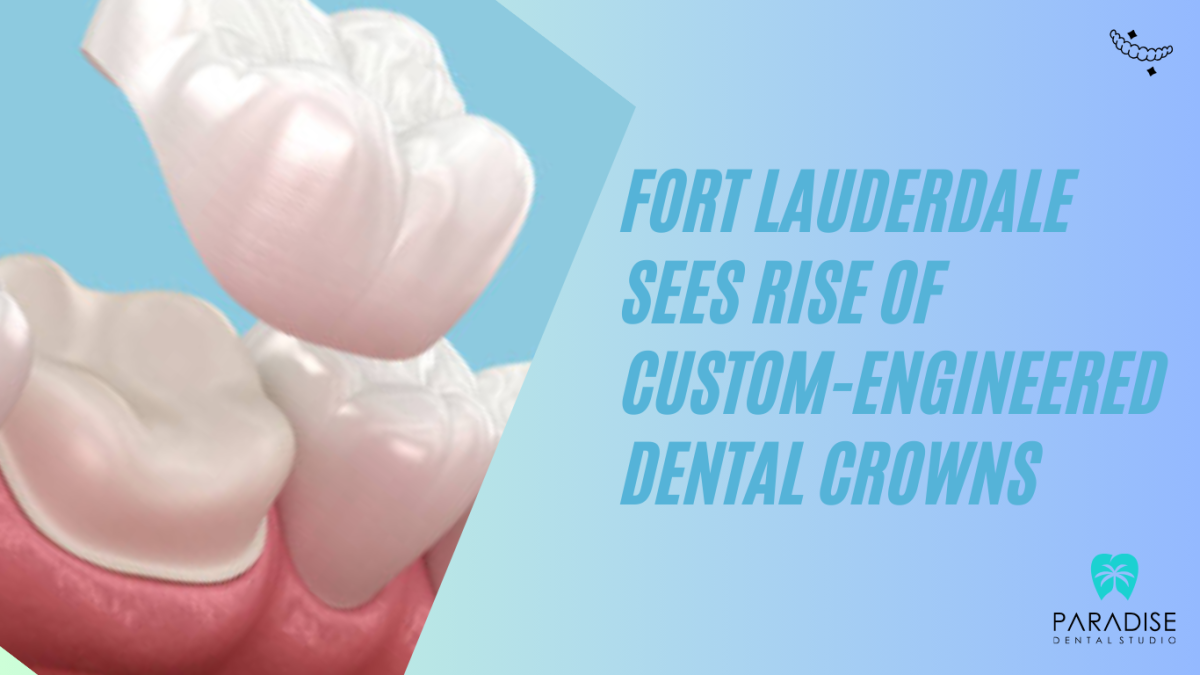 Fort Lauderdale Sees Rise of Custom-Engineered Dental Crowns