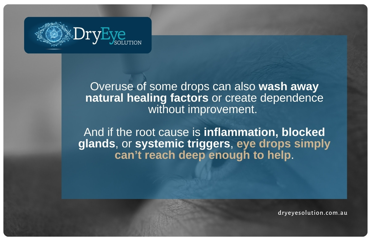 Dry Eye Clinic Double Bay | Why Eye Drops Aren't Solving Your Dry Eye Problem