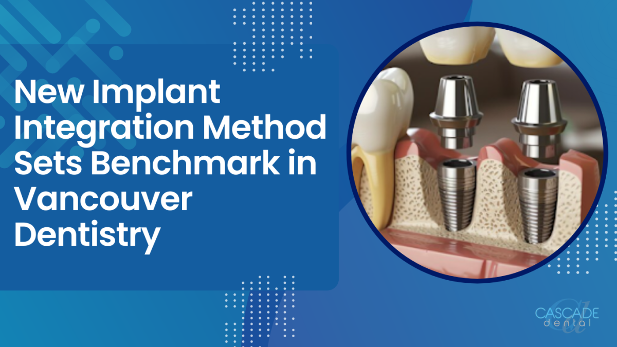 New Implant Integration Method Sets Benchmark in Vancouver Dentistry
