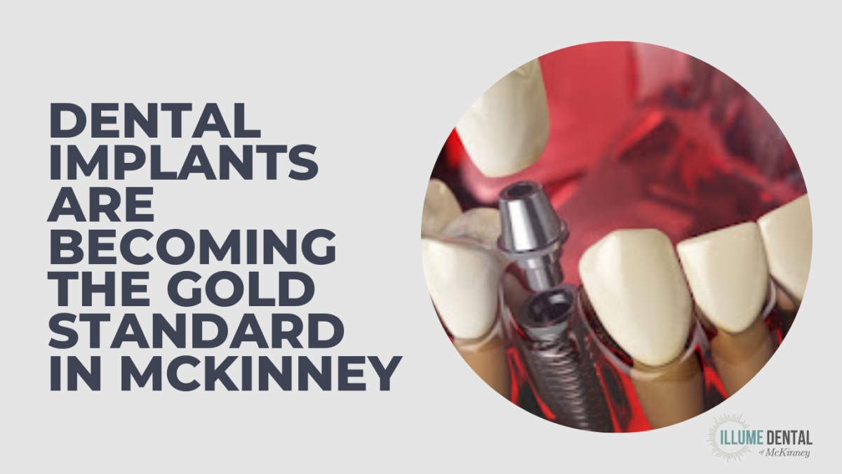 Featured image for Auto-prepared featured image